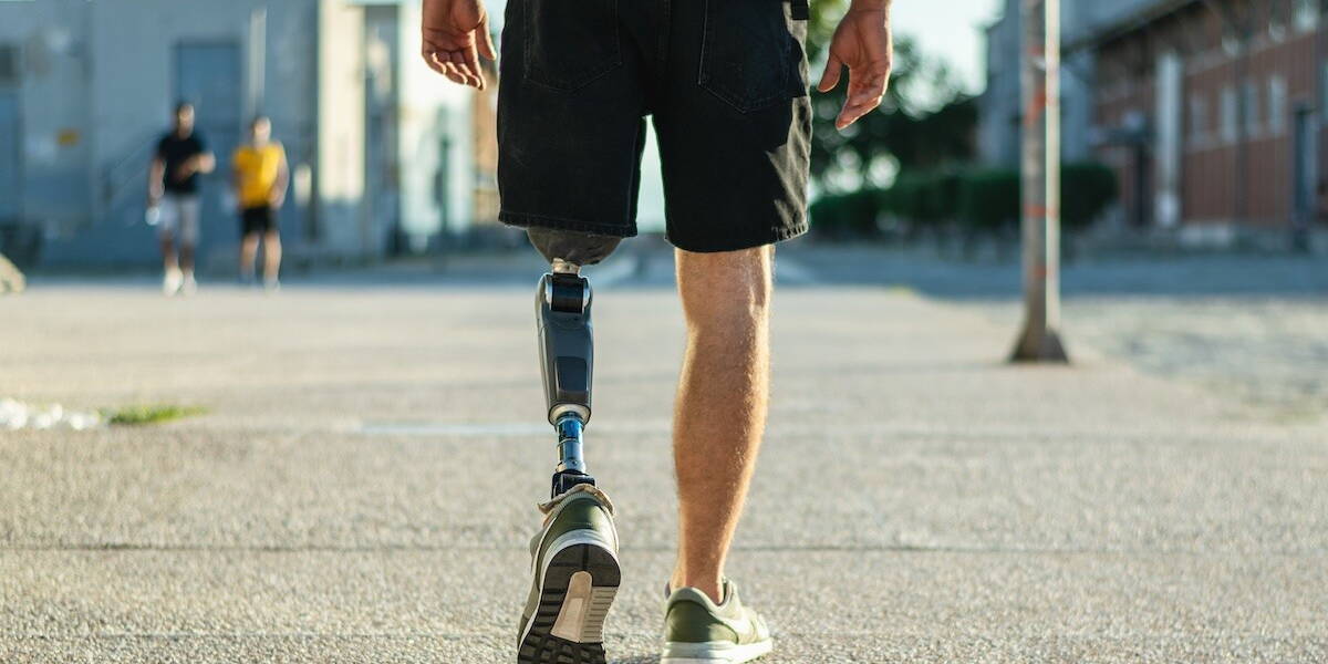 Man met geamputeerd been