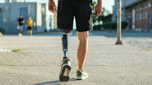 Digitale nazorg bij beenamputatie voorkomt ziekenhuisbezoek