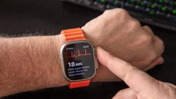 Smartwatches significantly improve detection of atrial fibrillation