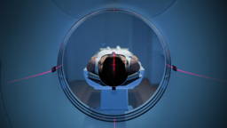 Smart MRI antenna delivers sharper scans