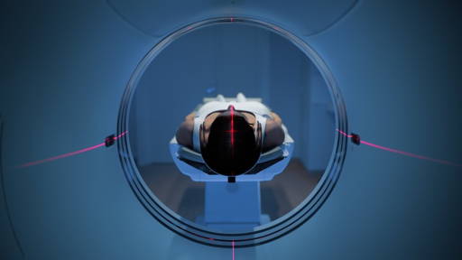 Betere diagnostiek alvleesklierkanker met nieuw AI-model