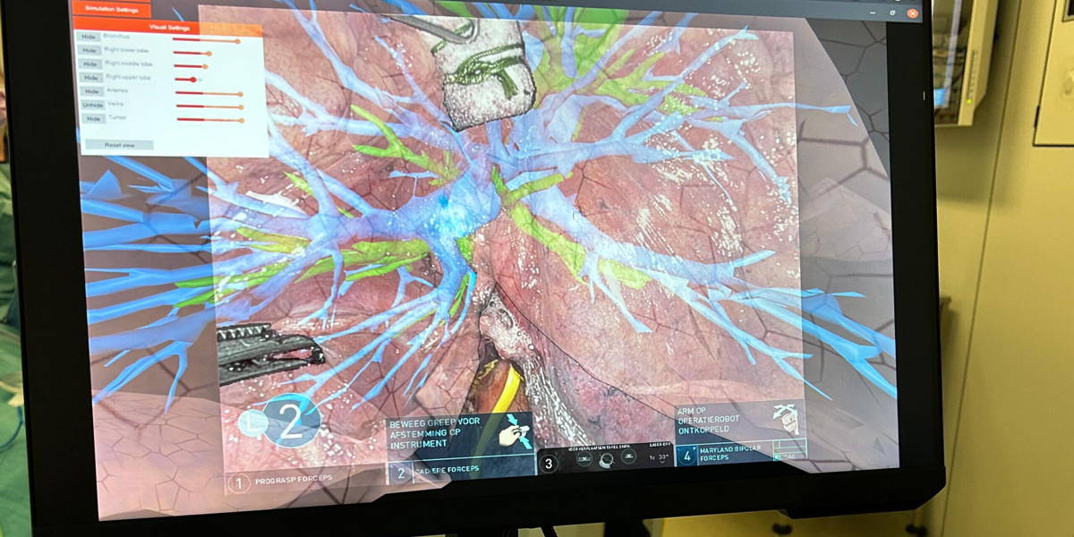 eerste-longoperatie-met-ar-in-rotterdam