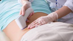 3D camera automates documentation of ultrasound positions