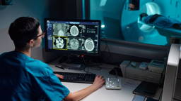 AI-model voorspelt hersenaandoeningen uit MRI-scans