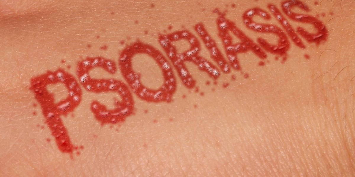 Psoriasis