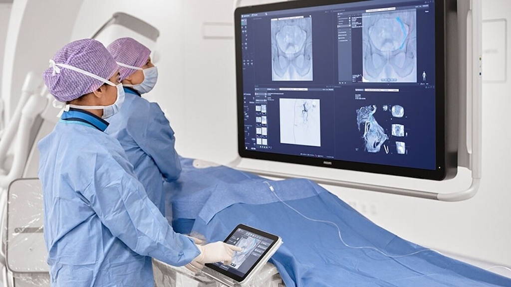 Afbeelding philips, azurion interventional oncology