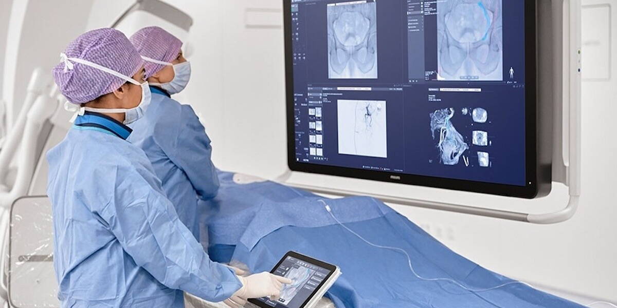 Afbeelding philips, azurion interventional oncology