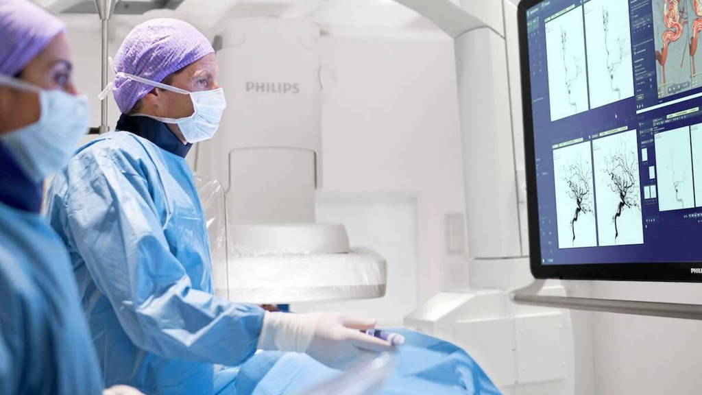 Philips-Innovatie-Beroerte-a