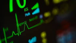 AI improves detection of hard-to-diagnose heart attacks