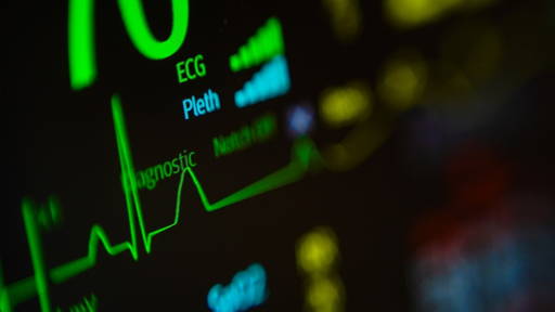 AI-analyse van ECG’s opent weg naar vroege opsporing van COPD