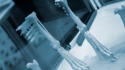 3D-geprinte implantaten bootsen menselijk bot na
