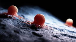 AI model predicts cancer metastasis risk from gene signatures