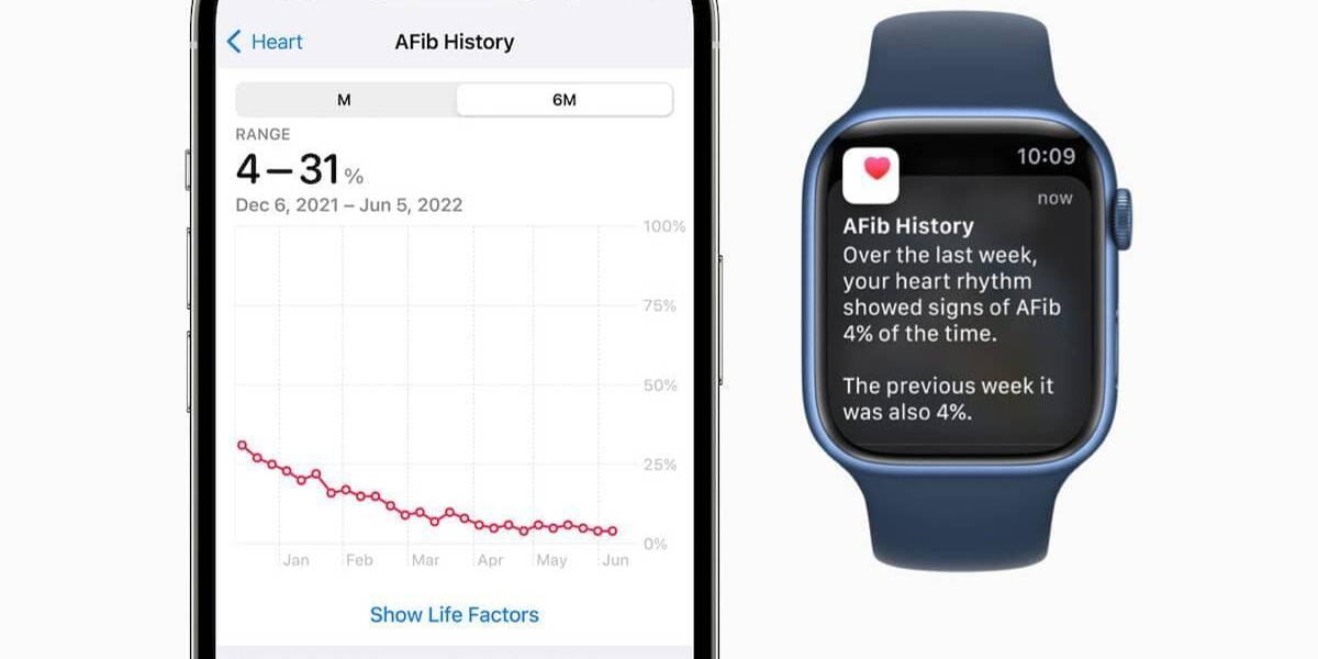 AppleWatch-AFib
