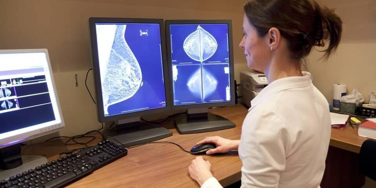 Diagnostiek-radiologie-AI