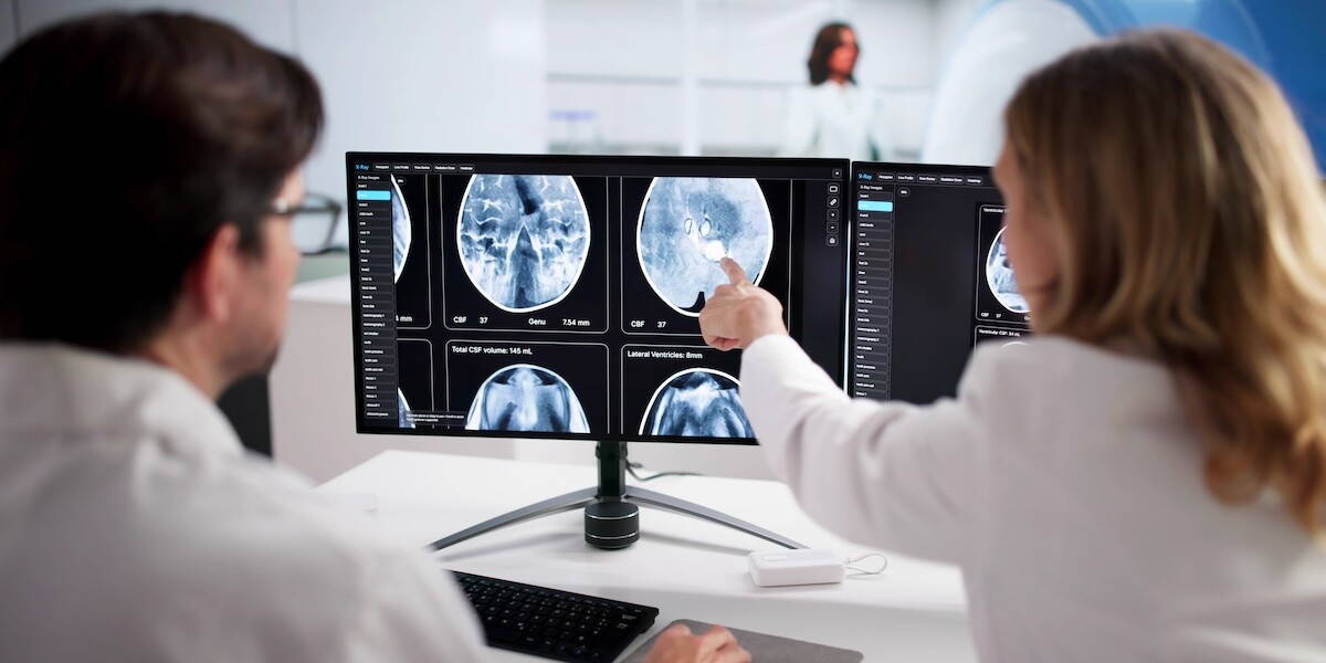 AI cuts advanced brain MRI scan time by 90%