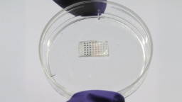 Slimme medicatiepleister versnelt herstel na hartinfarct