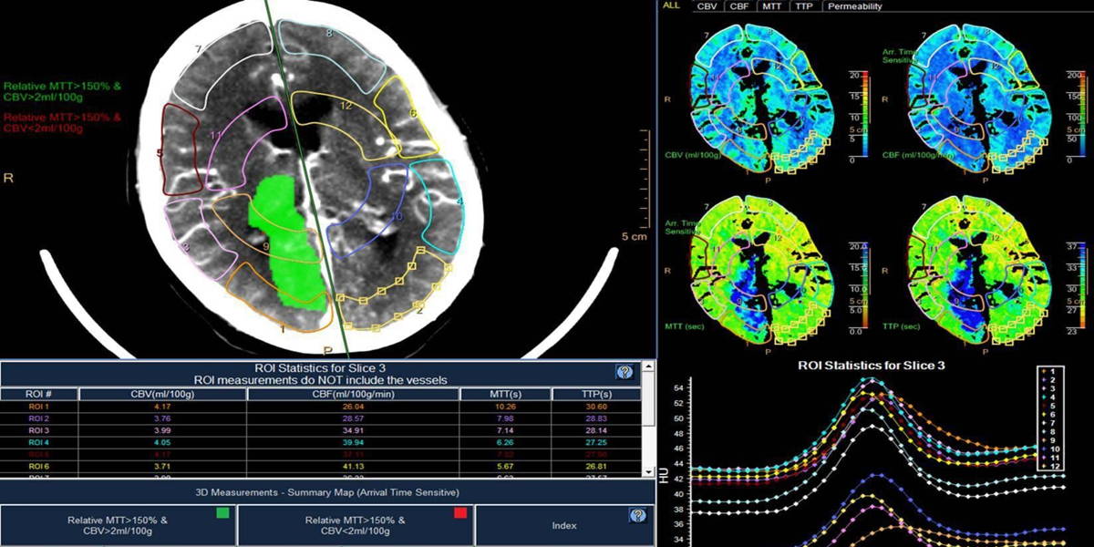 Philips wil beeldbeheer op volgend niveau brengen