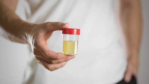 AI clock measures biological age by analyzing urine