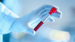 Liquid biopsy detects disease from a single drop of blood