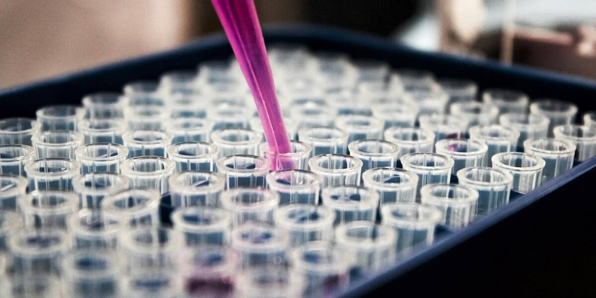 Onderzoek-Nierschade