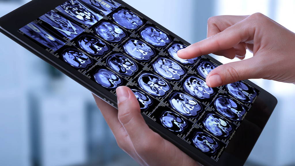 AI-ontwikkeling op radiologische beelden op zoek naar structuur