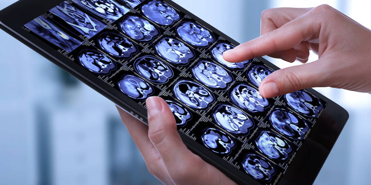 AI-ontwikkeling op radiologische beelden op zoek naar structuur