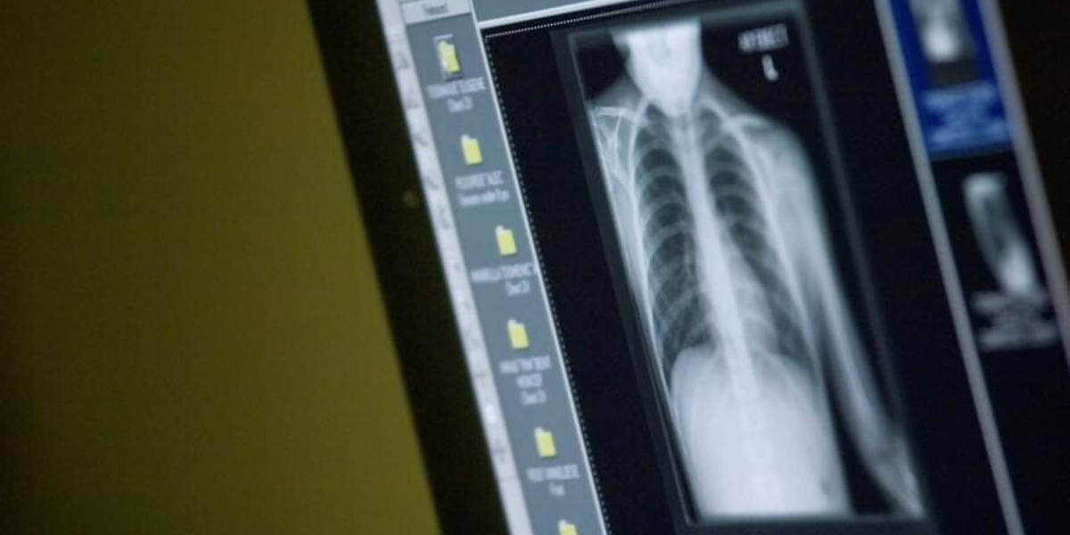 diagnostiek-radiologie-digitaal