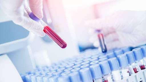 Bloedtest spoort risico op Alzheimer jaren eerder op