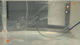 AI-robot navigeert zelfstandig naar hersenstolsel bij beroerte