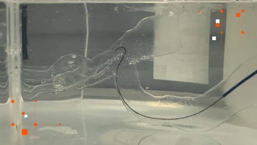 AI-robot navigeert zelfstandig naar hersenstolsel bij beroerte