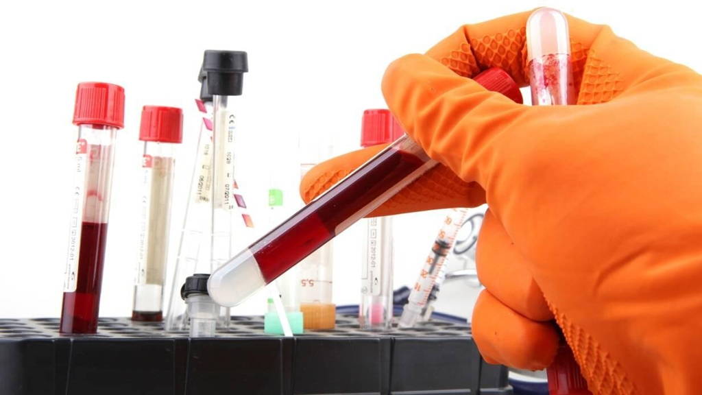 Laboratorium-onderzoek-klinisch