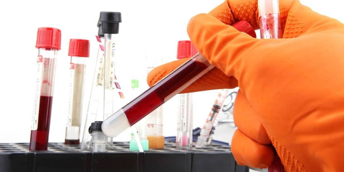 Laboratorium-onderzoek-klinisch