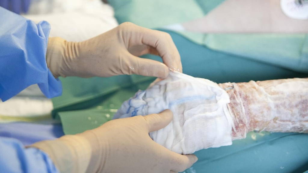 BWC_wondbehandeling_IMG_4333