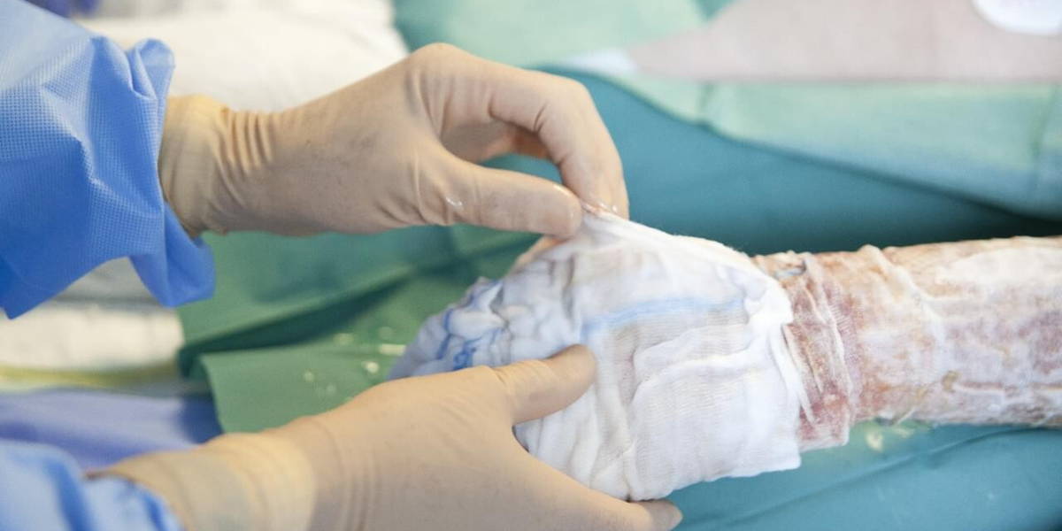 BWC_wondbehandeling_IMG_4333