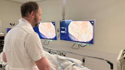 HagaZiekenhuis test meerwaarde AI bij endoscopie