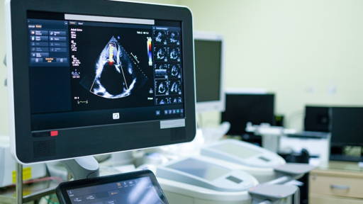 AI model may improve detection of advanced heart failure