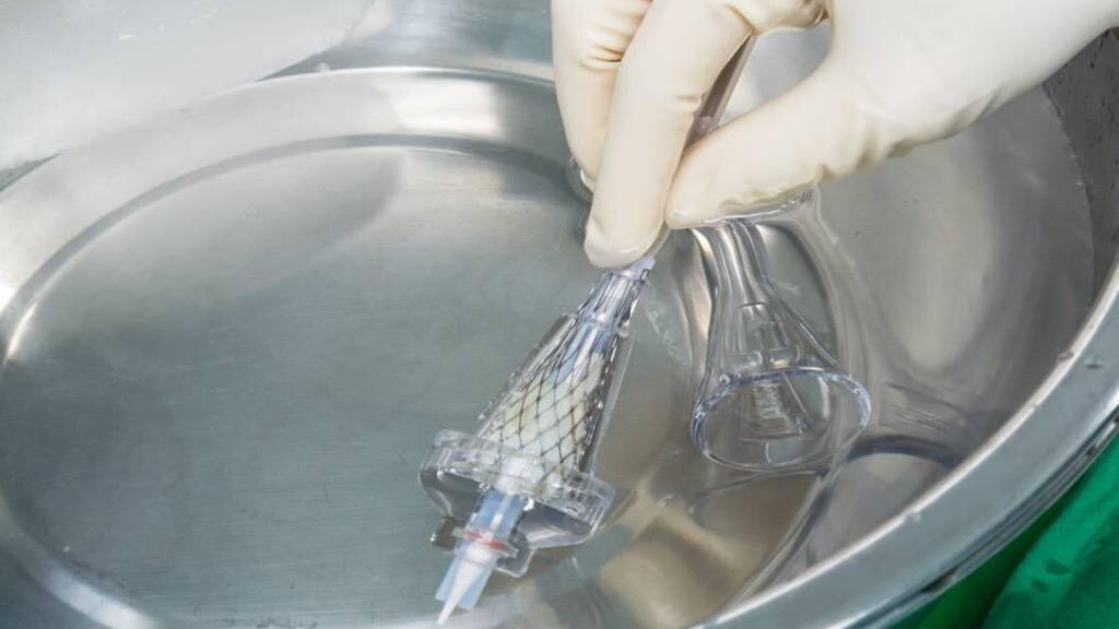 Horizonscan Medische Hulpmiddelen complex maar haalbaar