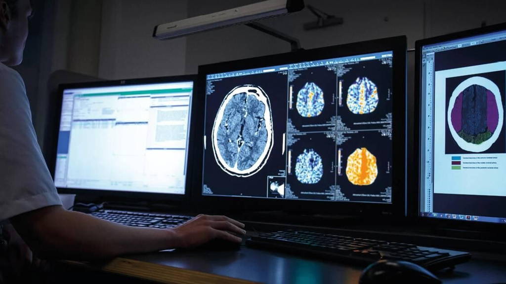 Doorbraken AI in zorg kunnen niet zonder samenwerking