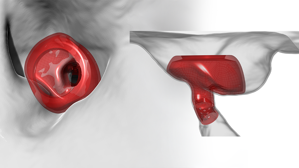 Van CT-scan naar 3D-print