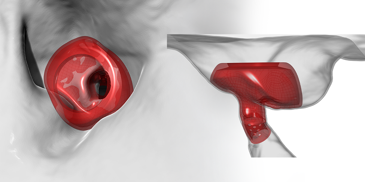 Van CT-scan naar 3D-print