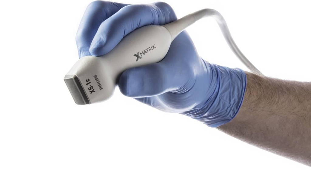 Philips-Echocardiografie