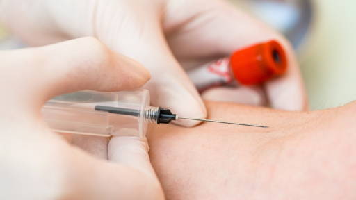 Microdruppel zweet op pleister alternatief voor bloedafname