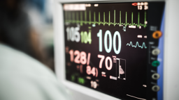 AI-ECG kan risico op hartfalen in een vroeg stadium opsporen