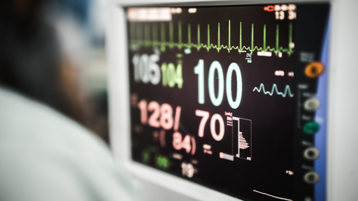 AI-ECG kan risico op hartfalen in een vroeg stadium opsporen