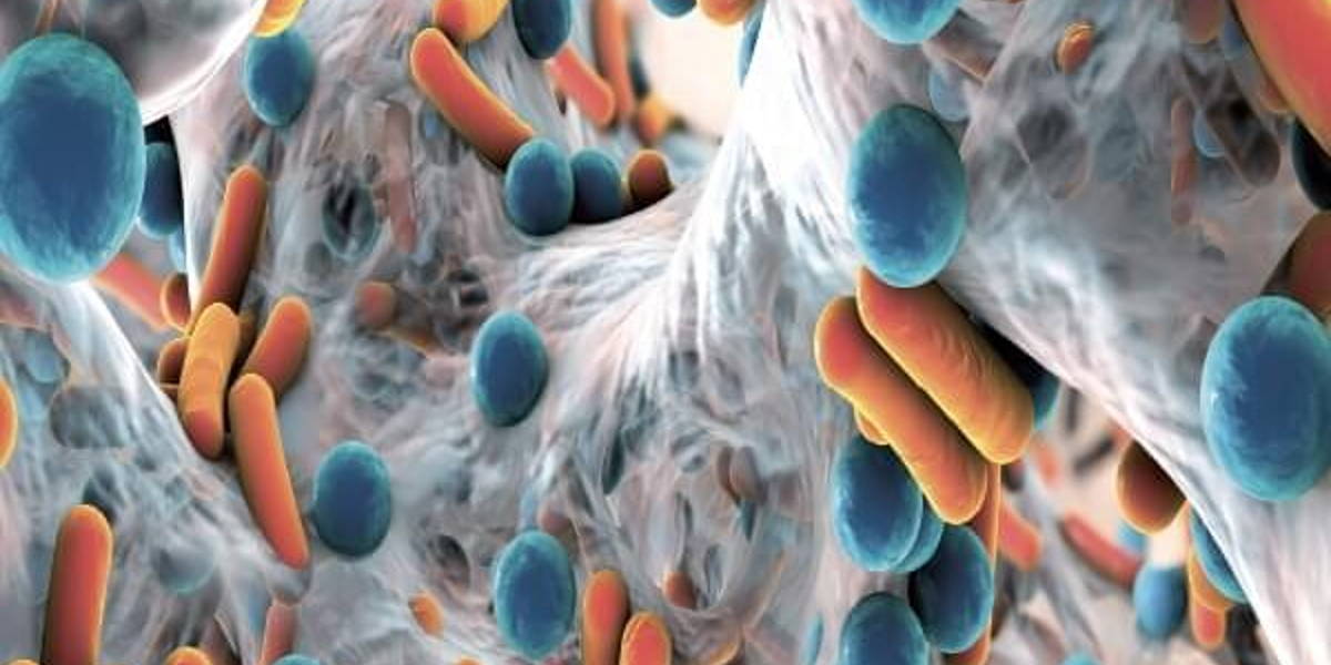 ‘Nederland kan gidsland worden bij ABR’