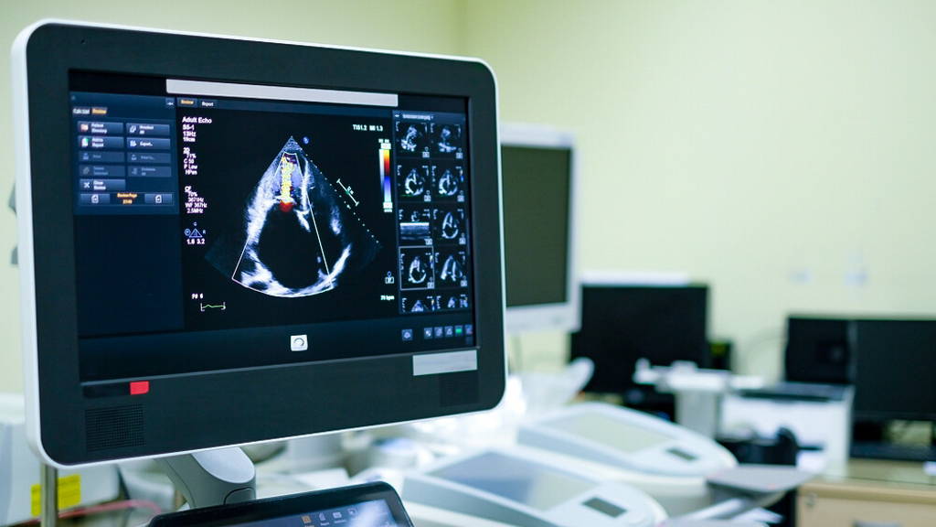 Echo cardiologie