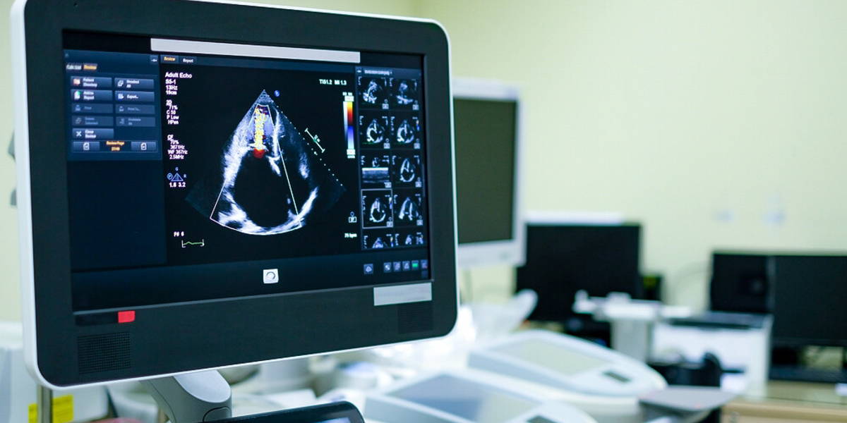 Echo cardiologie