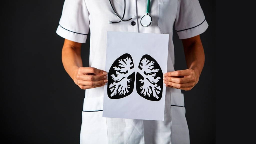 Arts-longen-tekening