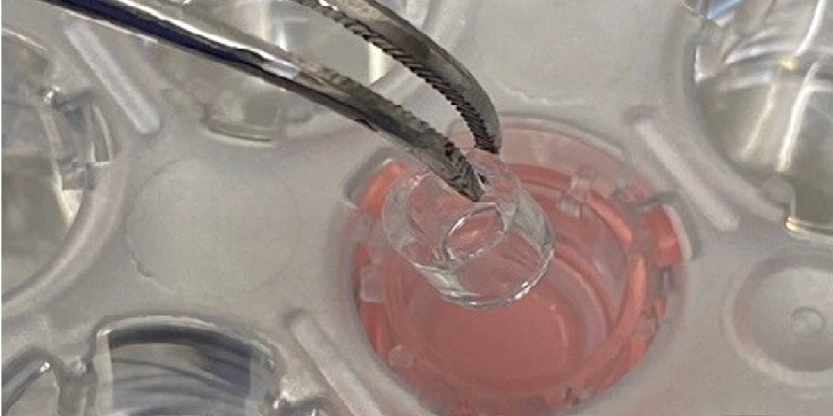 Radboudumc kunsthuid 2 2023