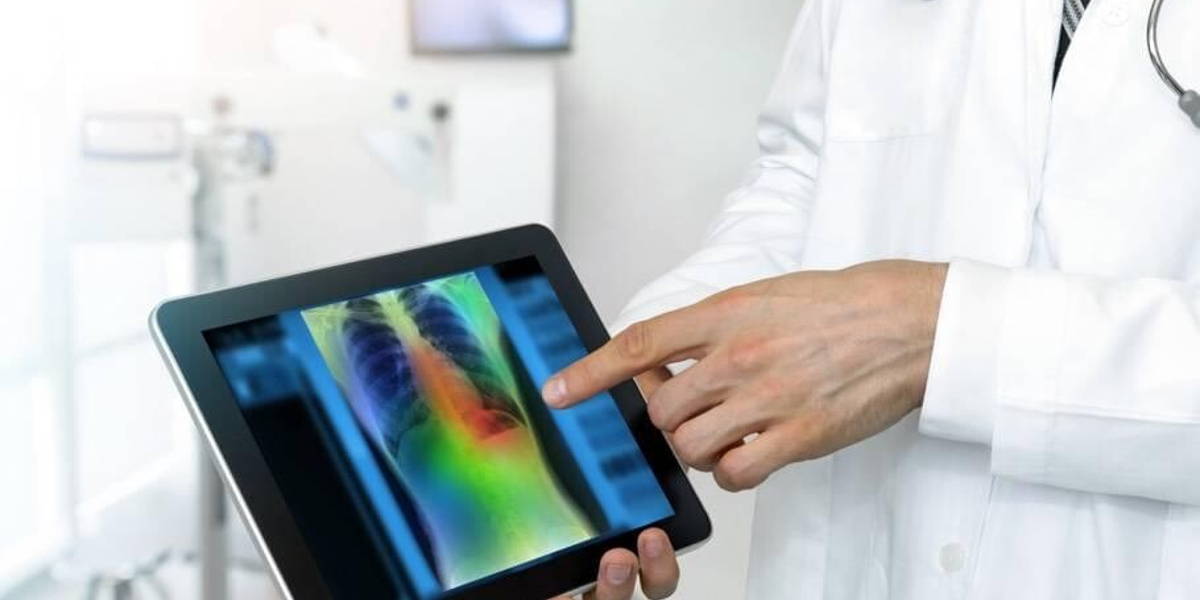 AI verankeren in de zorg: makkelijker gezegd dan gedaan